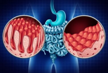 Celiac Disease and Malabsorption