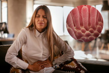 Refractory Celiac Disease