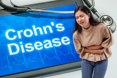Gluten and Crohn's Disease