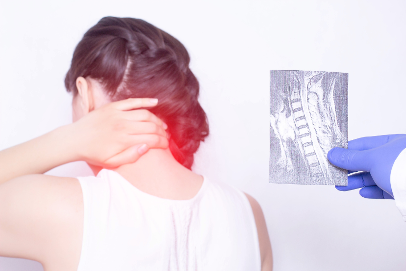 fibromyalgia and gluten intolerance
